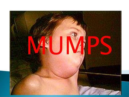 MUMPS MUMPS.