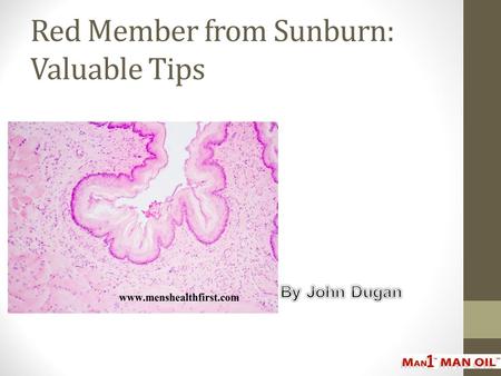 Red Member from Sunburn: Valuable Tips