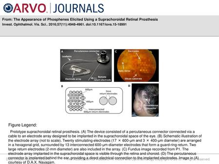 Invest. Ophthalmol. Vis. Sci ;57(11): doi: /iovs Figure Legend: