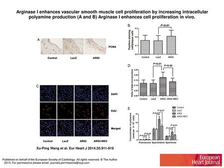 Arginase I enhances vascular smooth muscle cell proliferation by increasing intracellular polyamine production (A and B) Arginase I enhances cell proliferation.