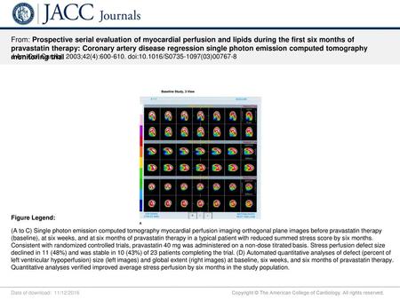 From: Prospective serial evaluation of myocardial perfusion and lipids during the first six months of pravastatin therapy: Coronary artery disease regression.