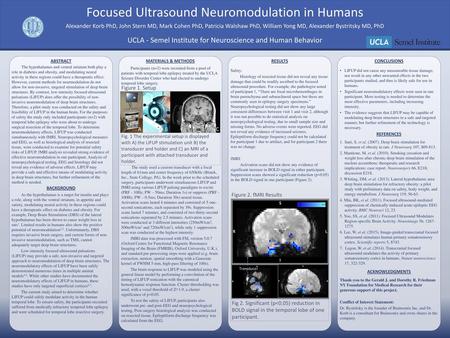 Focused Ultrasound Neuromodulation in Humans