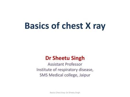 Basics of chest X ray Dr Sheetu Singh Assistant Professor