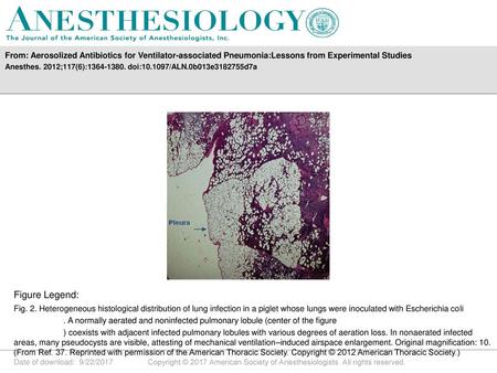 Anesthes. 2012;117(6): doi: /ALN.0b013e d7a Figure Legend: