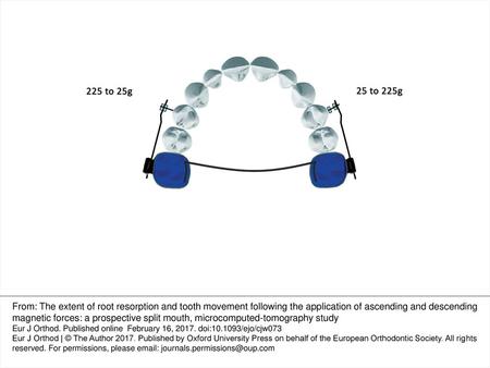 Figure 1. Diagrammatic presentation of appliance design, occlusal view. From: The extent of root resorption and tooth movement following the application.