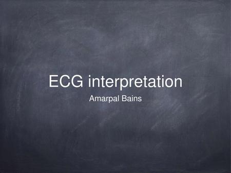 ECG interpretation Amarpal Bains.