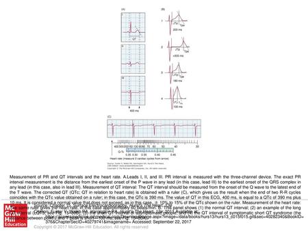 Measurement of PR and QT intervals and the heart rate. A