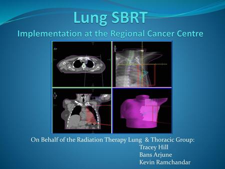 Lung SBRT Implementation at the Regional Cancer Centre