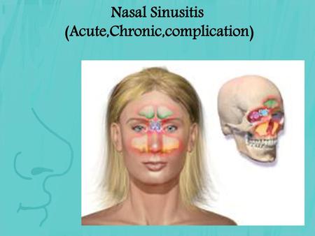 Nasal Sinusitis (Acute,Chronic,complication)