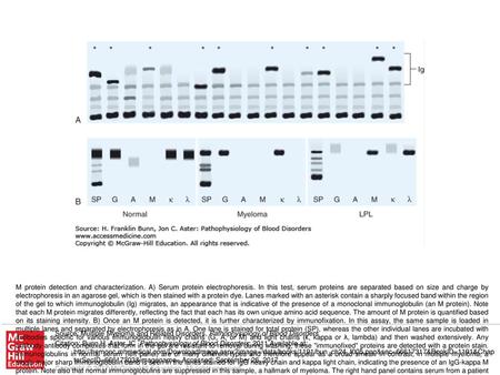 M protein detection and characterization