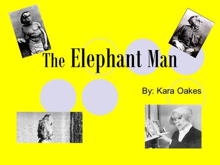 The Elephant Man By: Kara Oakes. Its called Neurofibromatosis Its a bunch of deformities and overgrowths on one side of the body. I.