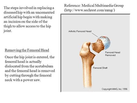 Reference: Medical Multimedia Group (http://www.sechrest.com/mmg/)