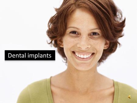 Dental implants.