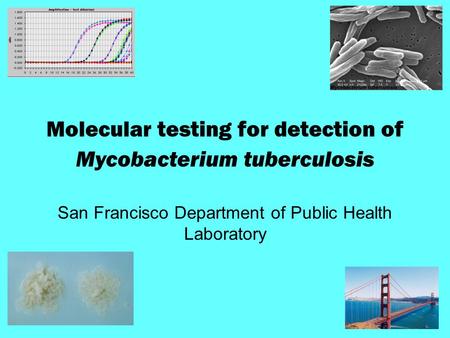 Molecular testing for detection of Mycobacterium tuberculosis San Francisco Department of Public Health Laboratory.