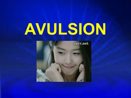 AVULSION.