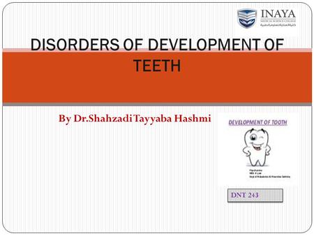 DISORDERS OF DEVELOPMENT OF TEETH