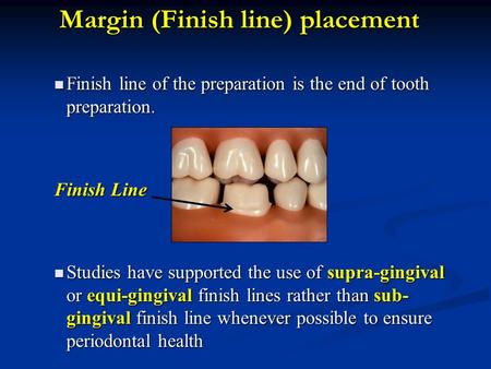 Margin (Finish line) placement