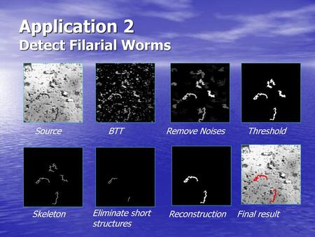 Application 2 Detect Filarial Worms