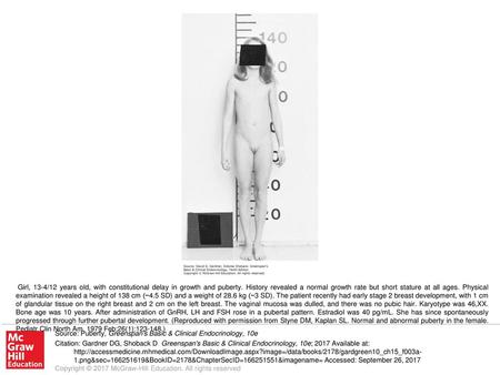 Girl, 13-4/12 years old, with constitutional delay in growth and puberty. History revealed a normal growth rate but short stature at all ages. Physical.