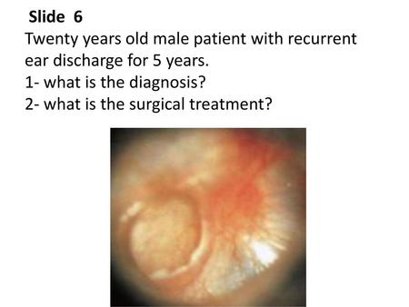 Slide 6 Twenty years old male patient with recurrent ear discharge for 5 years. 1- what is the diagnosis? 2- what is the surgical treatment?