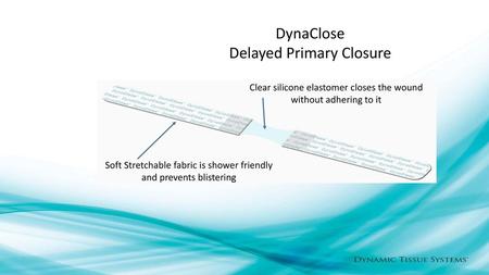 DynaClose Delayed Primary Closure