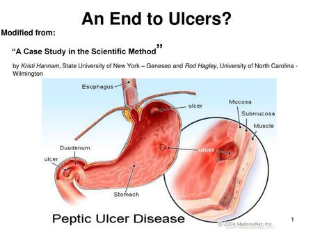 An End to Ulcers? Modified from: