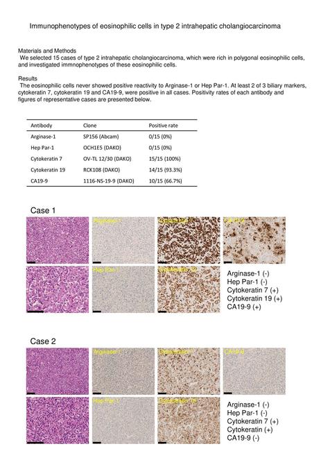 Immunophenotypes of eosinophilic cells in type 2 intrahepatic cholangiocarcinoma Materials and Methods We selected 15 cases of type 2 intrahepatic cholangiocarcinoma,