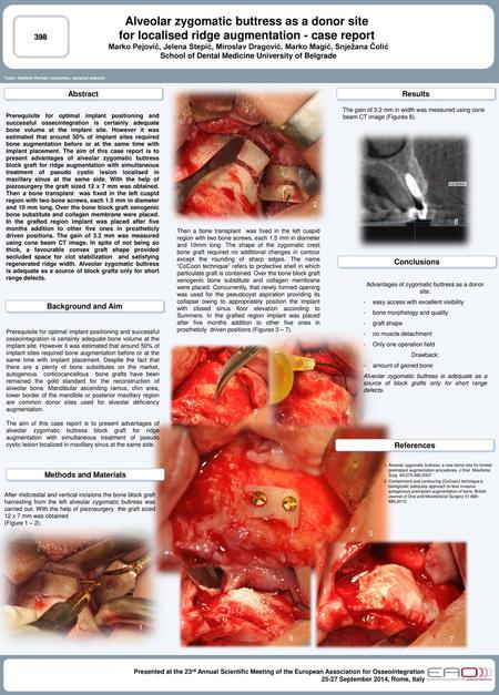 Alveolar zygomatic buttress as a donor site