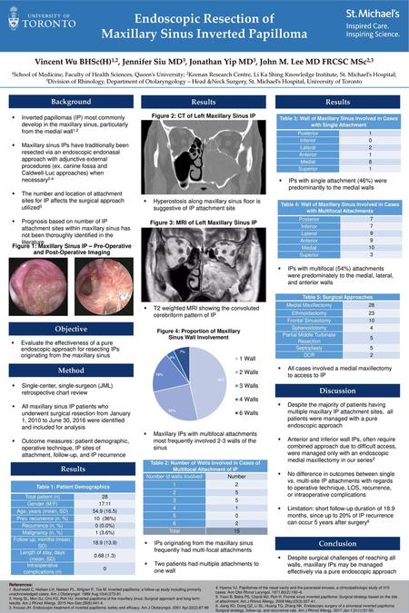 Endoscopic Resection of Maxillary Sinus Inverted Papilloma