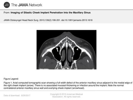 Copyright © 2013 American Medical Association. All rights reserved.