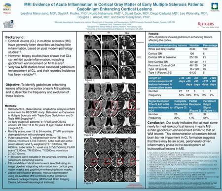 MRI Evidence of Acute Inflammation in Cortical Gray Matter of Early Multiple Sclerosis Patients: Gadolinium Enhancing Cortical Lesions Josefina Maranzano,