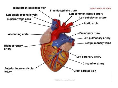 Right brachiocephalic vein