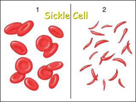 Sickle Cell.