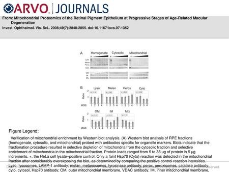 From: Mitochondrial Proteomics of the Retinal Pigment Epithelium at Progressive Stages of Age-Related Macular Degeneration Invest. Ophthalmol. Vis. Sci..