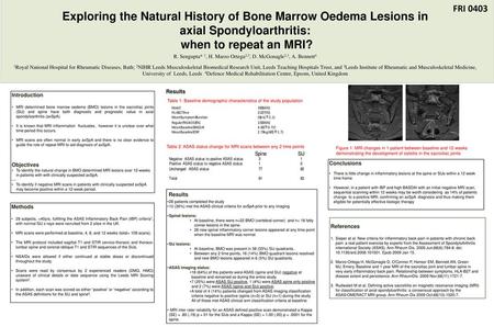 Exploring the Natural History of Bone Marrow Oedema Lesions in