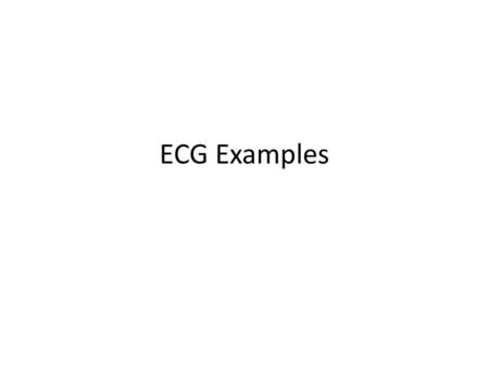 ECG Examples.