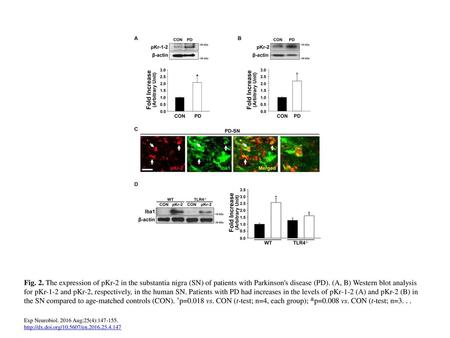 Fig. 2. The expression of pKr-2 in the substantia nigra (SN) of patients with Parkinson's disease (PD). (A, B) Western blot analysis for pKr-1-2 and pKr-2,