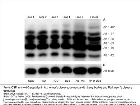 Fig. 1 Urea-based Aβ-SDS–PAGE/immunoblot (A) and conventional SDS–PAGE (B) of CSF (lane 1–4,6) and synthetic Aβ-peptides 1–37, 1–38, 1–39, 1–40, 1–42 (lane.