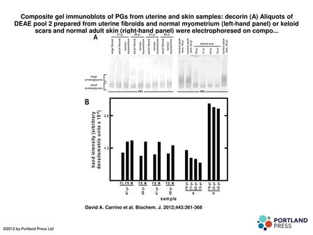 Composite gel immunoblots of PGs from uterine and skin samples: decorin (A) Aliquots of DEAE pool 2 prepared from uterine fibroids and normal myometrium.