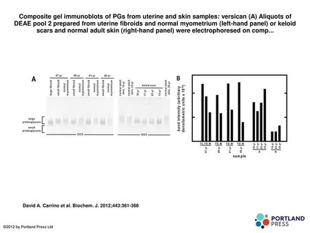 Composite gel immunoblots of PGs from uterine and skin samples: versican (A) Aliquots of DEAE pool 2 prepared from uterine fibroids and normal myometrium.