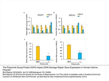 Fig. 1 Expression levels of DNA damage repair genes RAD51 and BRCA1 in fibroids (F) and adjacent myometrial tissues (MyoF) as well as primary cells. Each.