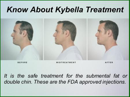 All Cons and Pros About the Kybella Treatment