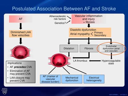 Postulated Association Between AF and Stroke