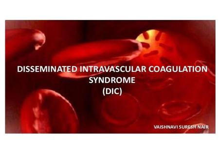 Disseminated Intravascular Coagulation