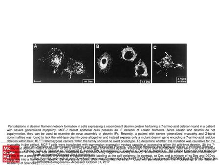 Perturbations in desmin filament network formation in cells expressing a recombinant desmin protein harboring a 7-amino-acid deletion found in a patient.