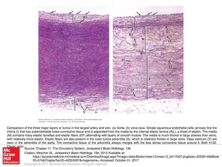 Comparison of the three major layers or tunics in the largest artery and vein. (a) Aorta, (b) vena cava. Simple squamous endothelial cells (arrows) line.