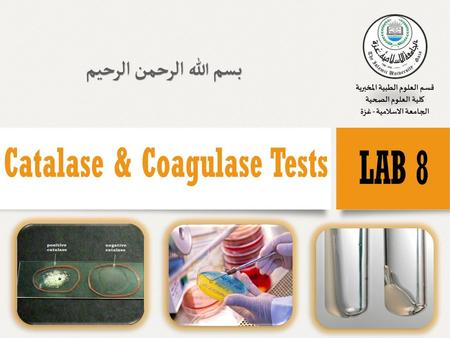 Enzymes In the microbiology lab, biochemical test relays on enzymes which is glycoprotein or protein that act as catalyst by lowering the activation.