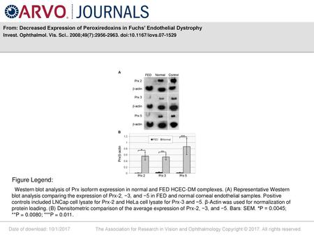 Invest. Ophthalmol. Vis. Sci ;49(7): doi: /iovs Figure Legend: