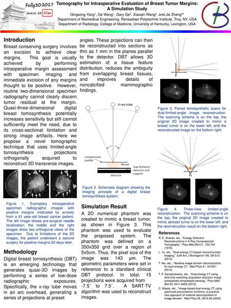 Tomography for Intraoperative Evaluation of Breast Tumor Margins: