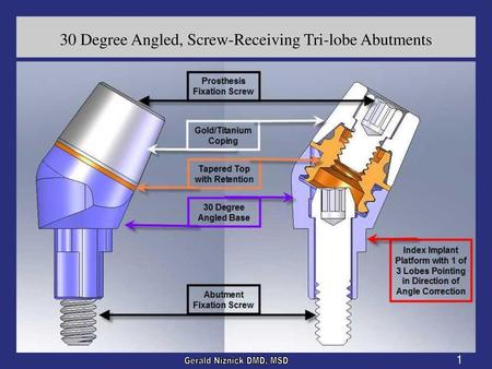 30 Degree Angled, Screw-Receiving Tri-lobe Abutments